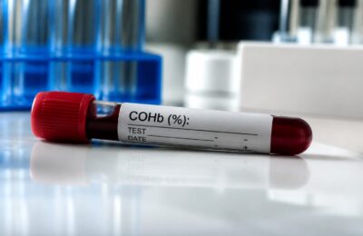 Un nou test de sânge poate semnala riscul de Alzheimer cu ani înainte de primele simptome