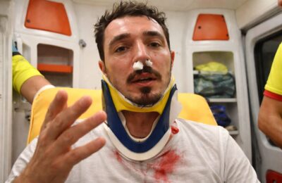 Ce înseamnă o fractură de piramidă nazală: cazul fotbalistului Dragoș Huiban, accidentat în timpul unui meci