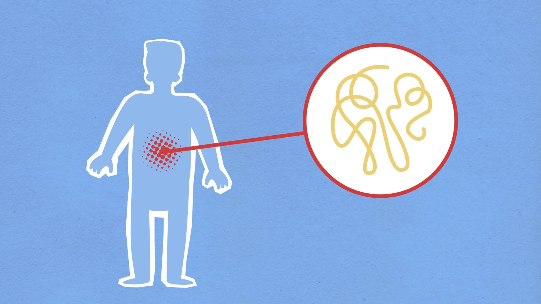 Infecție urinară bacteriană
